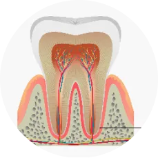 歯の適応の移植条件