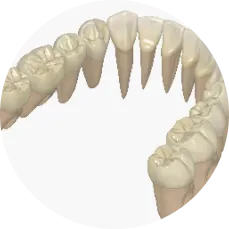 歯の適応の移植条件